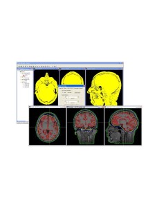 EMSE Image Processor