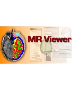 EMSE MR Viewer